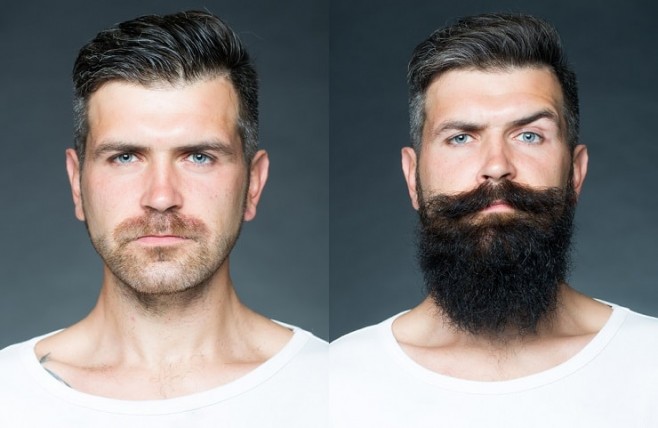 Quels sont les bienfaits de l'huile de ricin sur la barbe ?